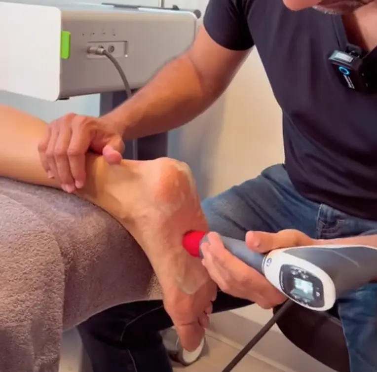 Shock Wave Therapy to Cure Plantar Fasciitis